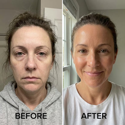 NMN Complex - Anti-Aging Support Formula
